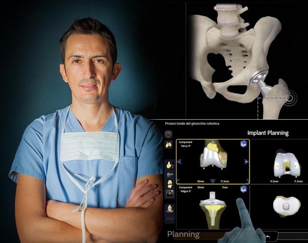 Dr. Alessio Biazzo Chirurgo Ortopedico Il Dott Alessio Biazzo, chirurgo ortopedico specialista in protesi mininvasiva del ginocchio e dell'anca, riceve a Bergamo, Cagliari, Oristano, Milano - Lombardia Emila Romagna Sardegna