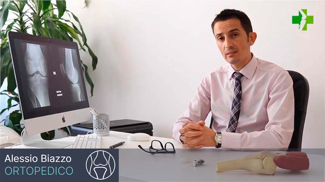 Dr. Alessio Biazzo Medico Chirurgo Ortopedico parla in questo video della protesi femororotulea