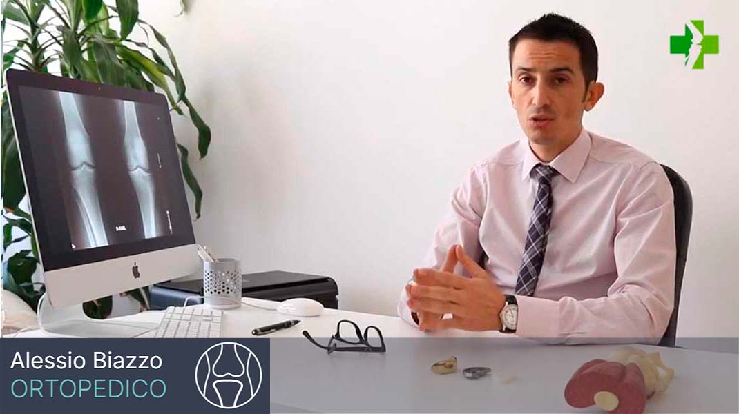 Dr. Alessio Biazzo Medico Chirurgo Ortopedico parla in questo video della protesi monocompartimentale del ginocchio