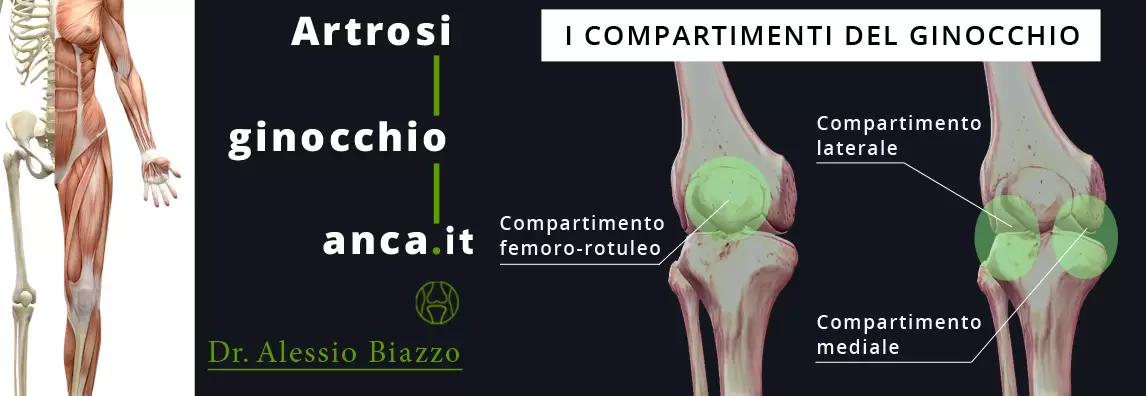 I compartimenti del ginocchio - Dott Alessio Biazzo Chirurgo Ortopedico I compartimenti del ginocchio interessati dalla chirurgia mininvasiva - Dott Alessio Biazzo Chirurgo Ortopedico