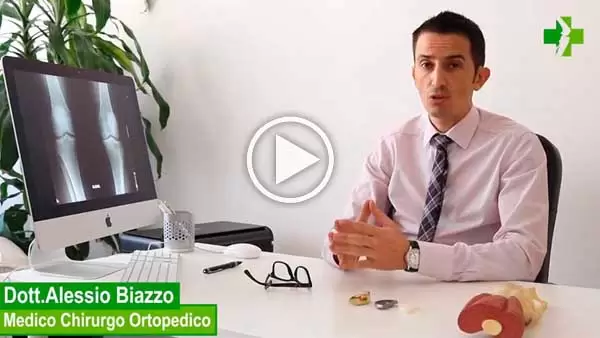 Protesi monocompartimentale ginocchio video di presentazione del Dott Alessio Biazzo Protesi monocompartimentale ginocchio video di presentazione del Dott Alessio Biazzo